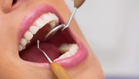 Estética periodontal